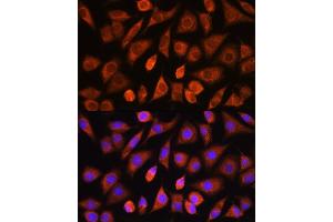 Immunofluorescence analysis of L929 cells using PHD2 antibody (ABIN3021559, ABIN3021560, ABIN3021561 and ABIN6215242) at dilution of 1:100. (EGLN1 antibody)