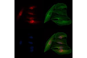 ABIN7093928 and ABIN7097972 staining  cells by IF/ICC.