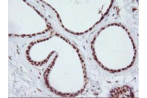 Immunohistochemical staining of paraffin-embedded Human breast tissue using anti-ENPEP mouse monoclonal antibody. (ENPEP antibody)