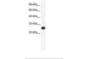 Image no. 1 for anti-General Transcription Factor IIF, Polypeptide 2, 30kDa (GTF2F2) (AA 132-181) antibody (ABIN202121) (GTF2F2 antibody  (AA 132-181))