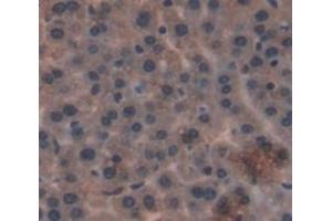 Used in DAB staining on fromalin fixed paraffin- embedded liver tissue (GLS2 antibody  (AA 154-479))