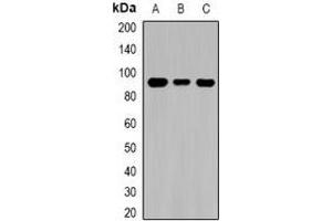 Western blot analysis of TGase1 expression in MCF7 (A), mouse kidney (B), rat brain (C) whole cell lysates. (TGM1 antibody)
