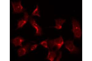 ABIN6266518 staining HuvEc by IF/ICC. (PTGS1 antibody  (C-Term))