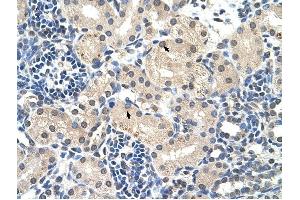 C14ORF130 antibody was used for immunohistochemistry at a concentration of 4-8 ug/ml to stain Epithelial cells of renal tubule (arrows) in Human Kidney. (UBR7 antibody  (Middle Region))