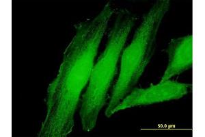 Immunofluorescence of purified MaxPab antibody to EXOSC1 on HeLa cell. (EXOSC1 antibody  (AA 1-195))