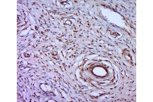 Paraformaldehyde-fixed, paraffin embedded rat uterus; Antigen retrieval by boiling in sodium citrate buffer (pH6. (MEF2D antibody  (pSer444))