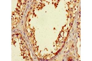 Immunohistochemistry of paraffin-embedded human testis tissue using ABIN7176179 at dilution of 1:100