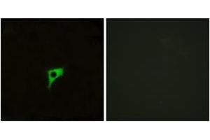 Immunofluorescence analysis of LOVO cells, using CHRM2 Antibody.