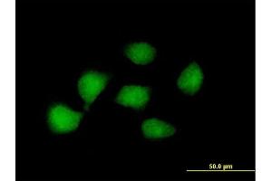 Immunofluorescence of purified MaxPab antibody to KLF8 on HeLa cell. (KLF8 antibody  (AA 1-359))