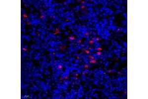 Immunofluorescence (Paraffin-embedded Sections) (IF (p)) image for anti-Baculoviral IAP Repeat Containing 3 (BIRC3) antibody (ABIN7073179)