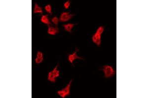 ABIN6274848 staining HeLa by IF/ICC. (AIG1 antibody  (C-Term))