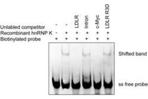 Activity Assay (AcA) image for Heterogeneous Nuclear Ribonucleoprotein K (HNRNPK) (Transcript Variant 1) (Active) protein (Myc-DYKDDDDK Tag) (ABIN2722924)