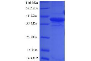 SDS-PAGE (SDS) image for Small Nuclear Ribonucleoprotein D2 Polypeptide 16.5kDa (SNRPD2) (AA 1-118), (full length) protein (GST tag) (ABIN5712245) (SNRPD2 Protein (AA 1-118, full length) (GST tag))