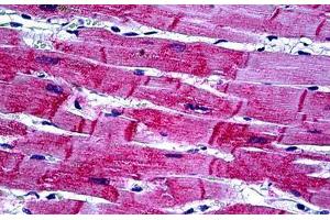 Human Heart: Formalin-Fixed, Paraffin-Embedded (FFPE) (HSPB8 antibody  (AA 97-197))