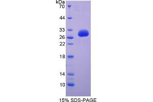 Image no. 1 for CD101 (CD101) (AA 566-784) protein (His tag) (ABIN4988711)