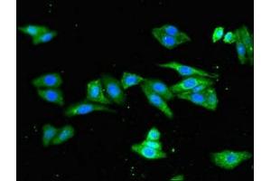 Immunofluorescent analysis of HepG2 cells using ABIN7163820 at dilution of 1:100 and Alexa Fluor 488-congugated AffiniPure Goat Anti-Rabbit IgG(H+L) (PKD1L1 antibody  (AA 921-1164))