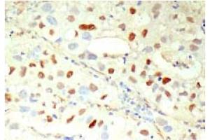 Immunohistochemistry (IHC) image for anti-Cyclin E1 (CCNE1) antibody (ABIN567783) (Cyclin E1 antibody)