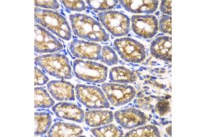 Immunohistochemistry of paraffin-embedded mouse Intestine using BMPR1B antibody (ABIN5971046) at dilution of 1/200 (40x lens). (BMPR1B antibody)