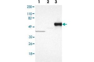 Western blot anyalysis of Lane 1: Human cell line RT-4, Lane 2: Human cell line U-251MG sp, Lane 3: Human plasma (IgG/HSA depleted) with SERPINA7 polyclonal antibody . (SERPINA7 antibody)