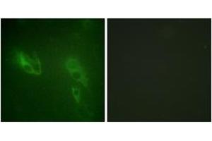 Immunofluorescence analysis of NIH-3T3 cells, using IR (Ab-999) Antibody. (IR (AA 881-930) antibody)