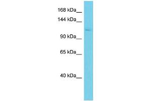 Host: Rabbit Target Name: ASAP2 Sample Type: MCF7 Whole Cell lysates Antibody Dilution: 1. (ASAP2 antibody  (N-Term))