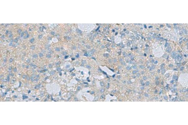 Cadherin 12 antibody