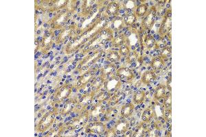 Immunohistochemistry of paraffin-embedded mouse kidney using CCNA2 antibody at dilution of 1:100 (x400 lens).