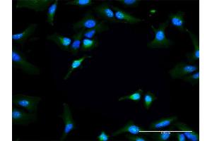 Immunofluorescence of purified MaxPab antibody to RAPGEF3 on HeLa cell. (RAPGEF3 antibody  (AA 1-881))