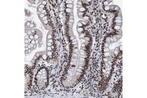 Immunohistochemical staining of human small intestine with EFTUD2 polyclonal antibody  strong cytoplasmic positivity in glandular cells at 1:200-1:500 dilution. (EFTUD2 antibody)