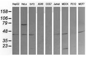 Image no. 6 for anti-Mitogen-Activated Protein Kinase Kinase 1 (MAP2K1) antibody (ABIN1499391) (MEK1 antibody)