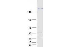 Validation with Western Blot (Dystrophin Protein (DMD) (Myc-DYKDDDDK Tag))