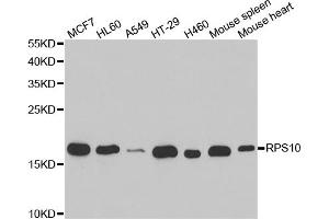Western blot analysis of extracts of various cell lines, using RPS10 antibody (ABIN5973486) at 1/1000 dilution.
