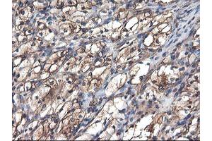 Image no. 1 for anti-Tubulin, alpha-Like 3 (TUBAL3) (AA 150-446) antibody (ABIN1490956) (TUBAL3 antibody  (AA 150-446))
