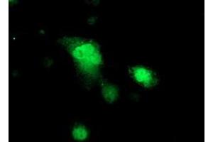 Immunofluorescence (IF) image for anti-Protein Kinase, CAMP-Dependent, Regulatory, Type I, beta (PRKAR1B) antibody (ABIN1500408)