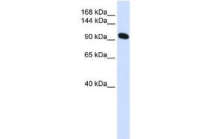 WB Suggested Anti-ACTN2 Antibody Titration:  0. (ACTN2 antibody  (N-Term))