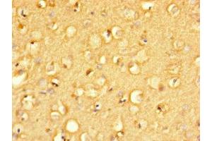 Immunohistochemistry of paraffin-embedded human brain tissue using ABIN7165793 at dilution of 1:100 (MANBAL antibody  (AA 45-85))