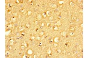 Immunohistochemistry of paraffin-embedded human brain tissue using ABIN7165793 at dilution of 1:100 (MANBAL antibody  (AA 45-85))