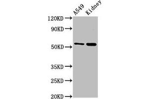 Western Blot Positive WB detected in: A549 whole cell lysate, Rat kidney tissue All lanes: AFG1L antibody at 3 μg/mL Secondary Goat polyclonal to rabbit IgG at 1/50000 dilution Predicted band size: 55 kDa Observed band size: 55 kDa (AFG1-Like ATPase (AFG1L) (AA 14-313) antibody)