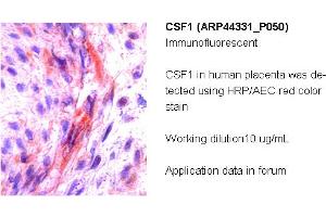 Image no. 2 for anti-Colony Stimulating Factor 1 (Macrophage) (CSF1) (Middle Region) antibody (ABIN2781824) (M-CSF/CSF1 antibody  (Middle Region))