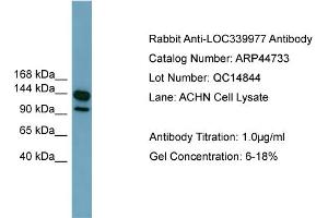 WB Suggested Anti-LRRC66  Antibody Titration: 0. (LRRC66 antibody  (Middle Region))
