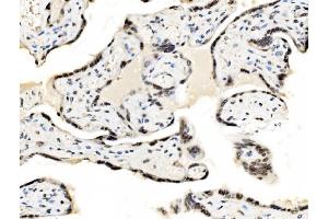 IHC analysis of JUNB using anti-JUNB antibody (ABIN7603223).