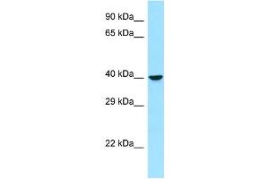 Western Blotting (WB) image for anti-Ras-Related GTP Binding B (RRAGB) (C-Term) antibody (ABIN2790375) (RRAGB antibody  (C-Term))