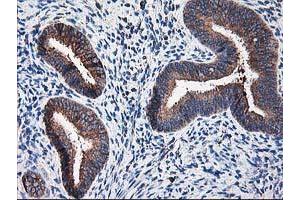 Image no. 10 for anti-Ribophorin 1 (RPN1) antibody (ABIN1500748)