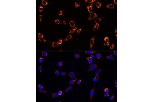 Immunofluorescence analysis of NIH/3T3 cells using TR antibody (ABIN1683134, ABIN5664756, ABIN5664758 and ABIN6220605) at dilution of 1:100. (TRAP1 antibody  (AA 445-704))
