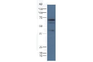 Rat brain lysates probed with Anti-Mfn1 Polyclonal Antibody  at 1:5000 90min in 37˚C. (MFN1 antibody  (AA 651-741))