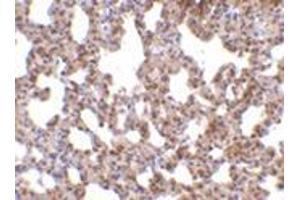 Immunohistochemistry of TRPC6 in mouse lung tissue with this product at 10 μg/ml. (TRPC6 antibody  (C-Term))