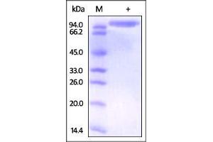 SDS-PAGE (SDS) image for Dipeptidyl-Peptidase 4 (DPP4) (AA 29-766) protein (ABIN2180980)