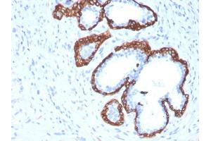 Immunohistochemistry (IHC) image for anti-Keratin 5 (KRT5) (AA 316-590) antibody (ABIN6939864)