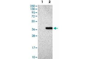 Western Blot analysis of Lane 1: negative control (vector only transfected HEK293T cell lysate) and Lane 2: over-expression lysate (co-expressed with a C-terminal myc-DDK tag in mammalian HEK293T cells) with MED4 polyclonal antibody . (MED4 antibody)
