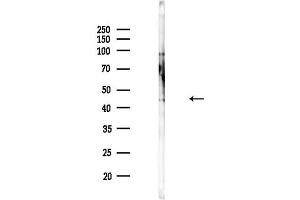 Western blot analysis of lysates from EC304 cells(LPS,4h treatment), using CXCR2 Antibody at 1/1000 dilution.
